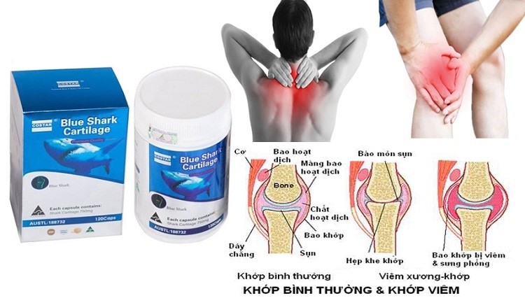 Sụn cá mập Costar Blue Shark Cartilage 750mg
