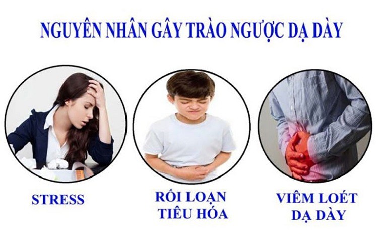 nguyên nhân trào ngược dạ dày
