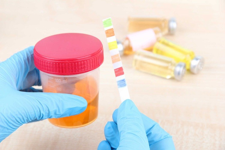 Xét nghiệm tầm soát