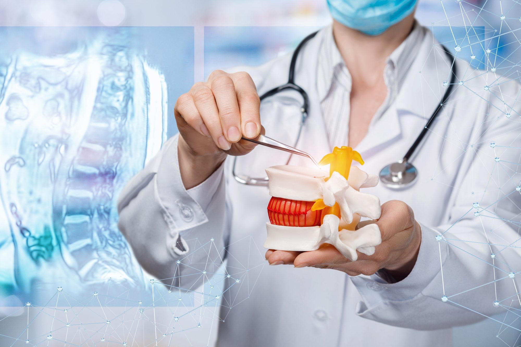 Có khá nhiều nguyên nhân dẫn tới phồng đĩa đệm