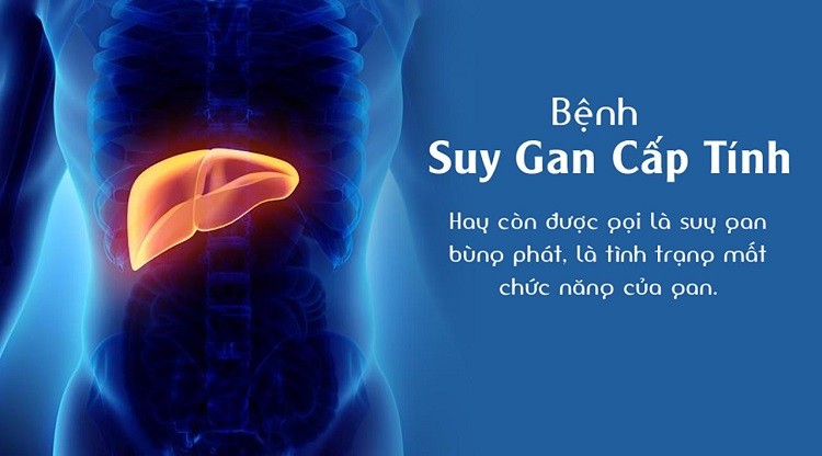 Suy gan cấp tính