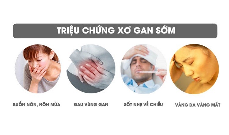 bệnh xơ gan là gì, xơ gan, bệnh xơ gan, triệu chứng xơ gan, bệnh xơ gan có chữa được không, bệnh xơ gan có lây không, điều trị xơ gan, dấu hiệu xơ gan