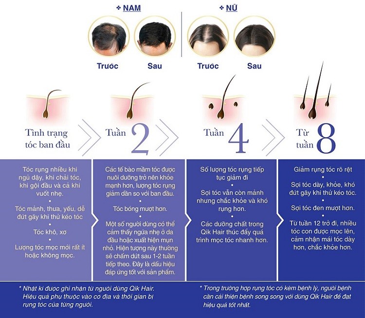 Qik Hair review webtretho có tốt không qik hair giá, qik hair giá bao nhiêu tiền, qik hair liều dùng, thuốc qik hair có tốt không, thuốc mọc tóc qik hair có tốt không, thuốc qik hair giá bao nhiêu, thuốc mọc tóc qik hair giá bao nhiêu, thuốc mọc tóc qik hair giá, review thuốc mọc tóc qik hair, đánh giá thuốc mọc tóc qik hair