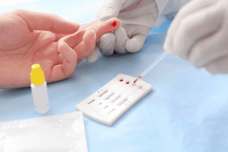 Dấu hiệu bệnh giang mai ở nam giới' alt=