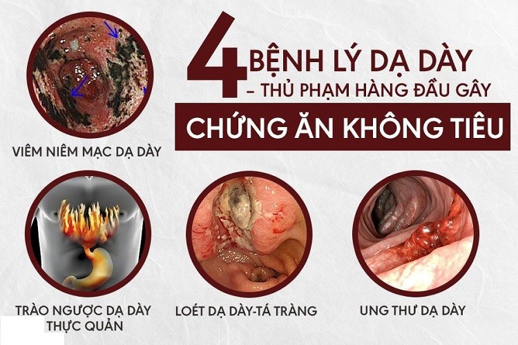 Ăn không tiêu phải làm sao ăn không tiêu phải làm sao, ăn không tiêu uống gì, ăn không tiêu khó thở, ăn không tiêu nên làm gì, ăn không tiêu đầy hơi, bé ăn không tiêu, ăn không tiêu uống thuốc gì, ăn không tiêu là bệnh gì, ăn không tiêu nên ăn gì, ăn không tiêu chướng bụng, ăn không tiêu uống gì cho hết, ăn không tiêu nên uống gì, bầu ăn không tiêu phải làm sao