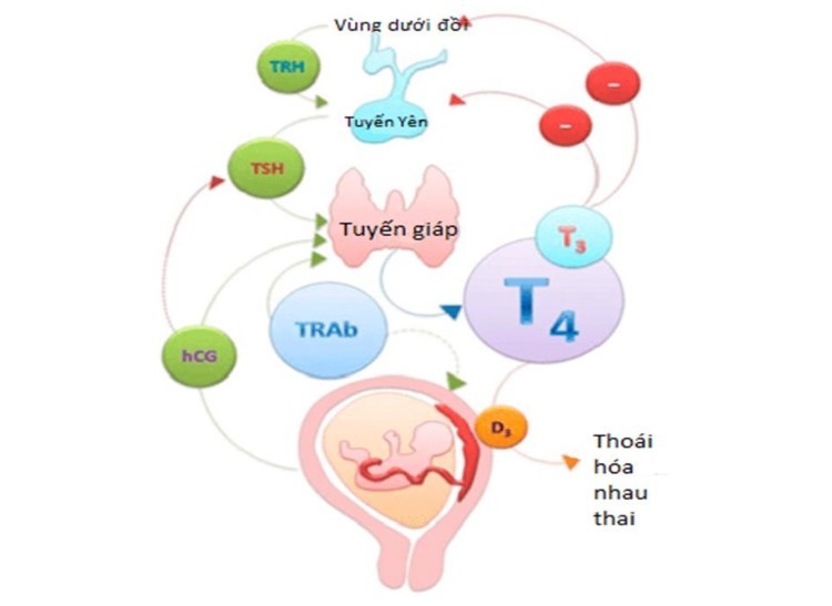 Bệnh cường giáp có thai được không Bệnh cường giáp có thai được không