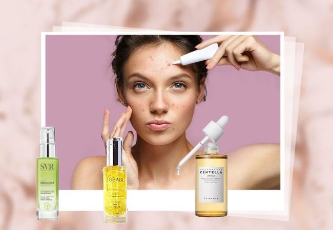 Cách chọn serum trị mụn trắng da phù hợp với tình trạng da